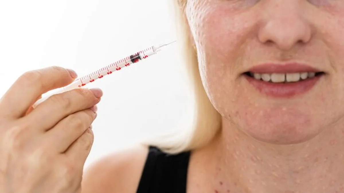 Kobieta z śladami zastrzyków hialuronowych na twarzy