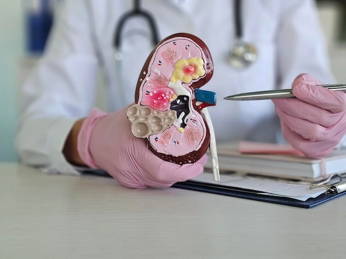 Lekarz trzyma plastikową makietę ludzkiej nerki