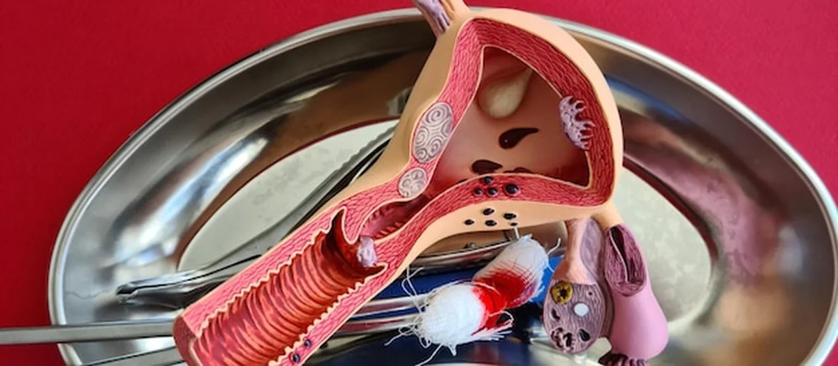 Model macicy i jajników obok skalpela i wyniku krwi