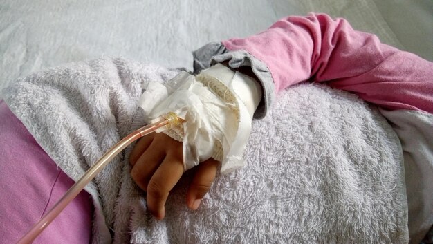 Uczucie gorąca pod gipsem – co to oznacza dla nogi w gipsie?